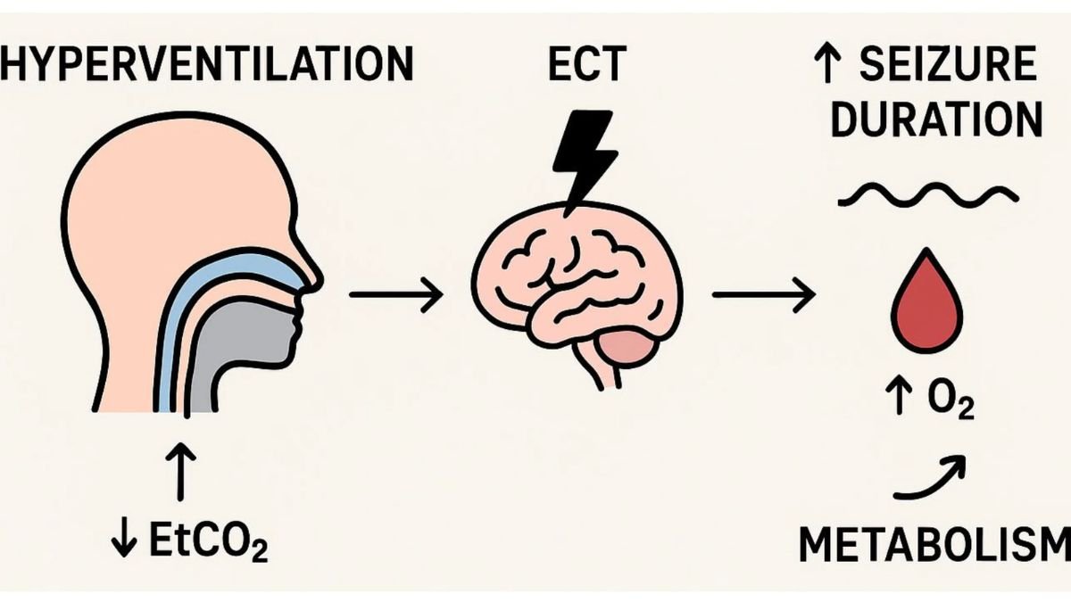 Electroconvulsive Therapy (ECT): History, Controversies, and Modern Use Explained